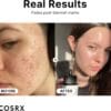 The Niacinamide 15 Serum