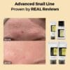 ALL ABOUT SNAIL KIT 4-step
